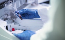 banner Scuola di Microbiologia Clinica riservata a non medici